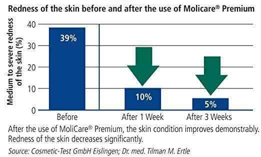 MoliCare Premium Mobile Adult Unisex Underwear - Moderate Absorbency Case of 56